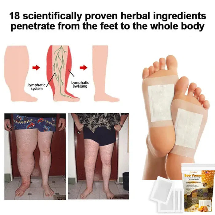 Bee Venom II Detox & Slimming Foot Patches (Set of 10+10) - Buy 10 Get 10 Free